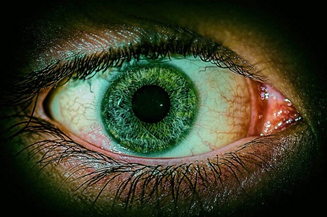 ihhumaneyemarksgonepublic